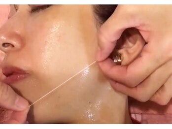 ラクル(RAKURU)の写真/話題のリフトアップをエステサロンで☆糸で引き上げる！ほうれい線/たるみ緩和◎結果重視の方必見♪