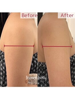 美温(mion)/脂肪分解レッドショット