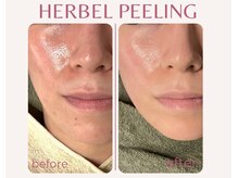 ジプソフィラフィフティドット(gypsophira15.)/