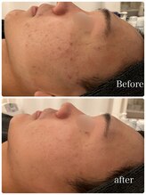 カラン(CALIN)/最高峰ブラックハーブ