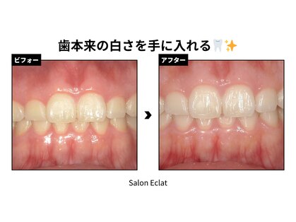 サロン エクラ(Salon E'clat)の写真