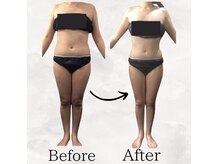 レナータ バイ アフロスクィーン(Renata by Aphros Queen)/Before&After