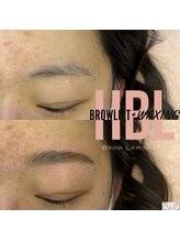 エリス(ELISSE)/ハリウッドブロウリフト