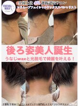 エリス(ELISSE)/うなじ脱毛