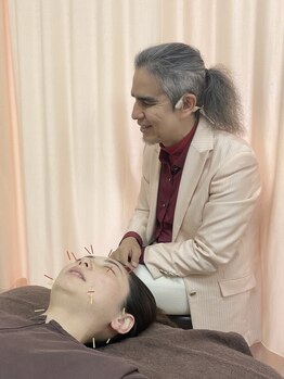 ビューティーパンク 黒田鍼治療院(Beauty Punc)/12美容背術中のお話は?