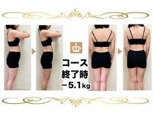 産後骨盤矯正ダイエットセンター 天王寺 阿倍野/産後骨盤矯正＆エステ