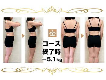 産後骨盤矯正ダイエットセンター 天王寺 阿倍野/産後骨盤矯正＆エステ