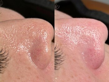 ルーナジェーナ(Luna llena)/池袋 エステ ルーナジェーナ