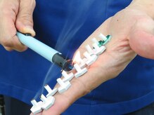 ひまわり鍼灸接骨院/お灸