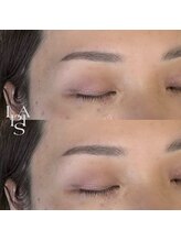 フレイズラピス(FRASE Lapis)/ハリウッドブロウリフト