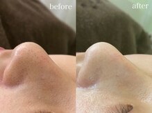 テオリア(TEORIA)/学生の方でも毎月通える価格♪