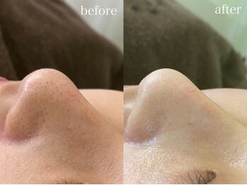 テオリア(TEORIA)/学生の方でも毎月通える価格♪