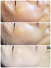 ビビィ(VIVIE)/若々しさを目指せ！