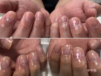 ディーア(Diae.)/Jessicaネイルケア初回～半年後