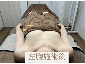 ロココ 国立店(Rococo)/☆片胸施術後