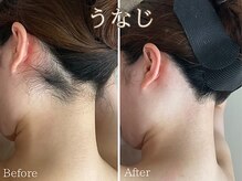 シエナ(ciena)/うなじシュガーリング脱毛