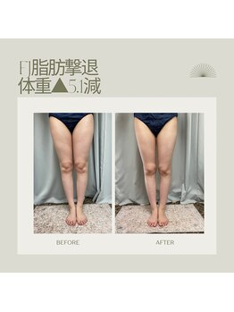 FJ/脂肪撃退コース