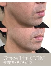 エムネ ラボ 大阪本町(M/NE &nbsp;LAB)/グレイスリフト×LDM