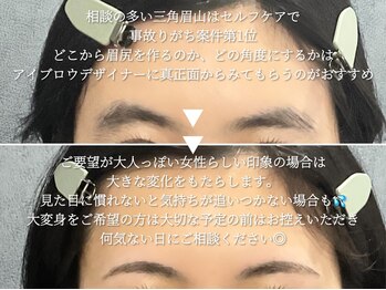 サルレ(Sarule)/濃いめ悩み1