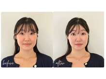 スタイルキューピット(style cupit)/メイクビフォアフター＊20代