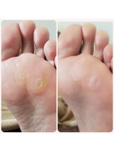 遊歩堂/Before★Ａｆｔｅｒ★