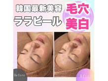 ホワイトアクア 三ノ宮店(WHITE AQUA)の雰囲気（韓国で話題沸騰中!最新☆第4世代『ララピール』で憧れの水光肌に）