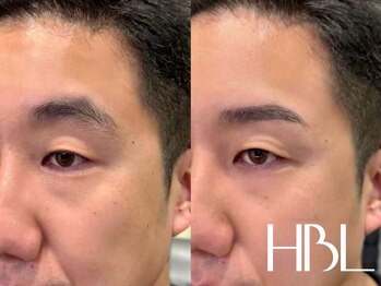 ワクシー 麻布十番店(WAXYYY.)/ハリウッドブロウリフト¥3,900～