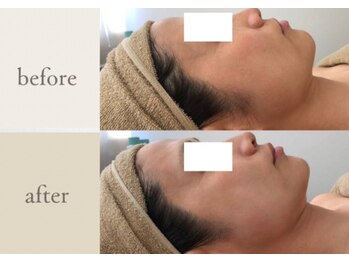 エルマ(elma)/コルギ90分before&after