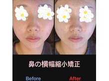 美容矯正サロン レレポノ(LELEPONO)/