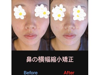 美容矯正サロン レレポノ(LELEPONO)/