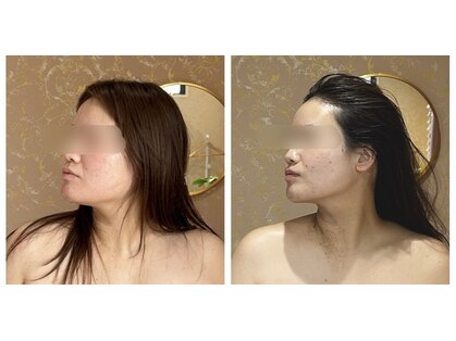 コンジュ(kongju)の写真