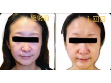 サロンモコ(Salon Moco)/