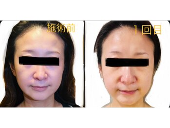 サロンモコ(Salon Moco)/