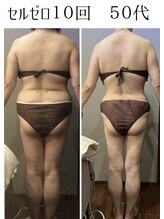 ムーン 高崎店(MOON)/痩身エステ50代