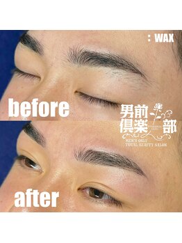男前倶楽部/脱毛/メンズ脱毛/メンズ専門店