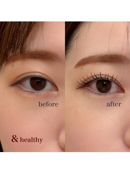 リンダ(LINDA)/&healthy