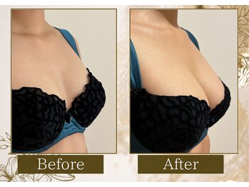 マリン(MARINE)/Before→After