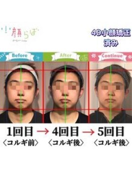 小顔整体研究所 KSラボ 新潟中山店/