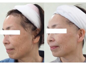 仙豆のちから 自由が丘店/テラボーラー9回の変化