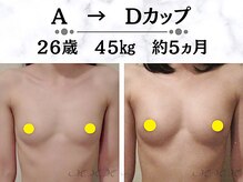 メディカルサロン エム エム エム 心斎橋本店(M.M.M)の雰囲気(ボリュームUP技術が豊富!寄せ集めるのではなく内側からバストUP)