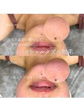 サーラ(SA-RA)/口周りワックス