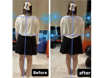 カワル整体 上通り院/初回の変化