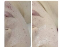 リセラージュ(Recellage)/潤艶waxと毛穴洗浄ケア