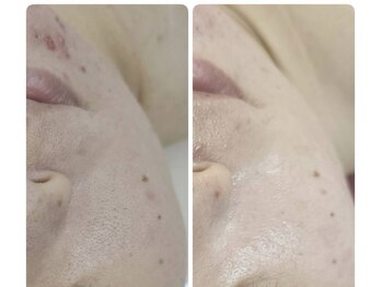 リセラージュ(Recellage)/潤艶waxと毛穴洗浄ケア