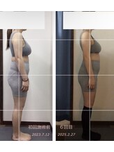 サロン ナウ オア ネバー(Salon Now or Never)/気象からの頭痛、食いしばりも