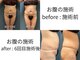 ビーホープ(B.hope)の写真/ぽっこりお腹を卒業！40代から始める理想のウエストづくり。何をしても痩せないお腹に、本気のサイズダウン