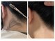 ビーエム アンド ワイ(BM and Y)の写真/顔のうぶ毛・うなじも即ツルツル♪Wax +光でミックス脱毛！！