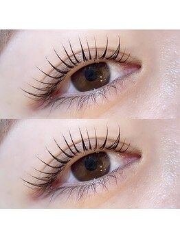 アトモス サニーテラス(Atmos sunny terrace)/ピーナッツロッド