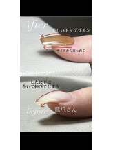 ライクネイル 本店(RaiK NaiL)/私の爪でも綺麗にできますか？