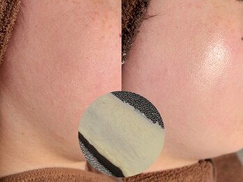 ルーナジェーナ(Luna llena)/池袋 エステ ルーナジェーナ